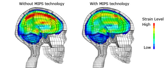 Diferencia de fuerzas ejercidas sobre el cerebro sin y con MIPS